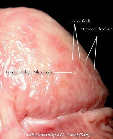 Com’e’ fatto il pene e come funziona - Dr. Francesco De Luca